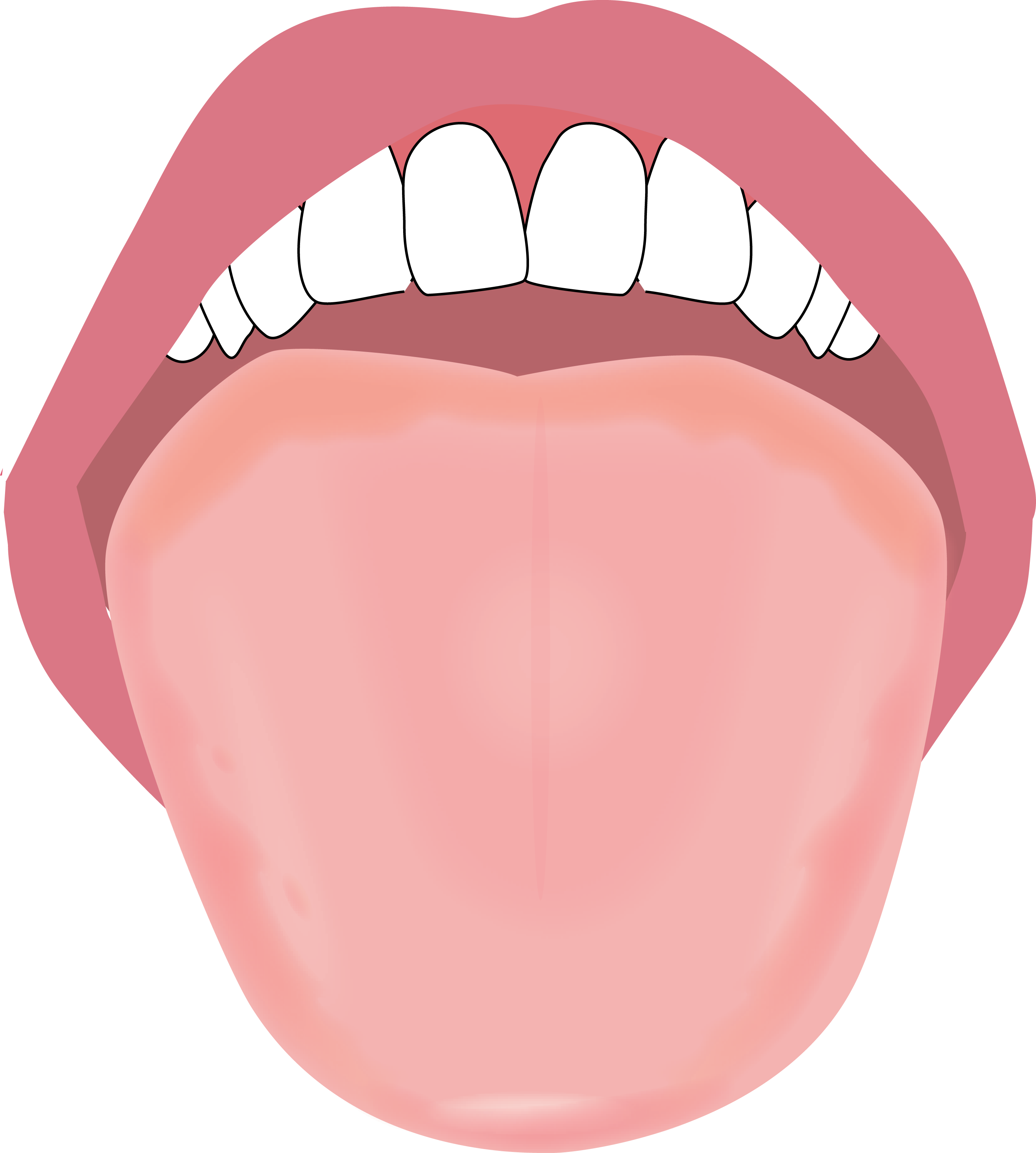 舌のイラスト描きました やましろ歯科口腔外科 口腔外科 口腔内科 福岡で親知らずの抜歯 ドライマウス 睡眠時無呼吸症候群 口腔がん 健診のことならやましろ歯科口腔外科へ 日本口腔外科学会認定専門医が治療します