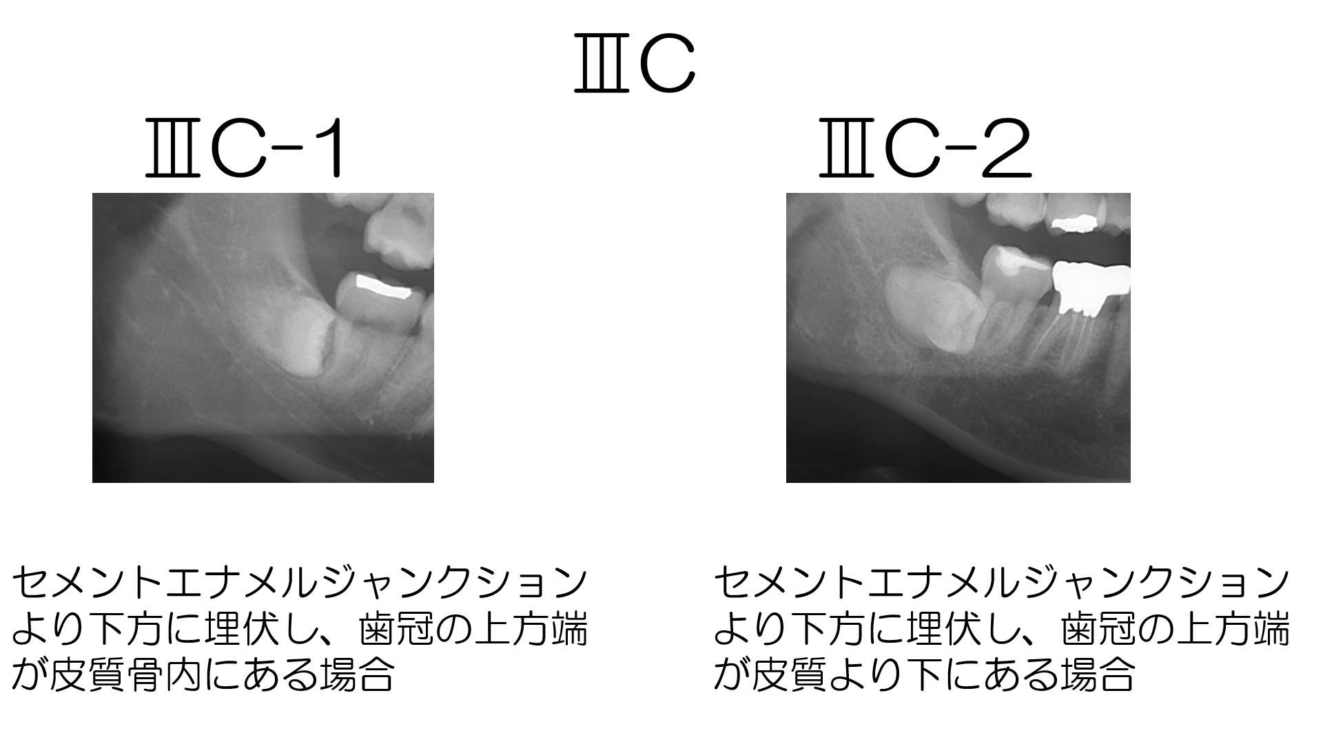 最大85 オフ イラストでみる口腔外科手術 第２巻 クインテッセンス出版 日本口腔外科学会 Afb Tsujide Co Jp